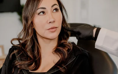Hyperpigmentation and Melasma: Why It Comes Back